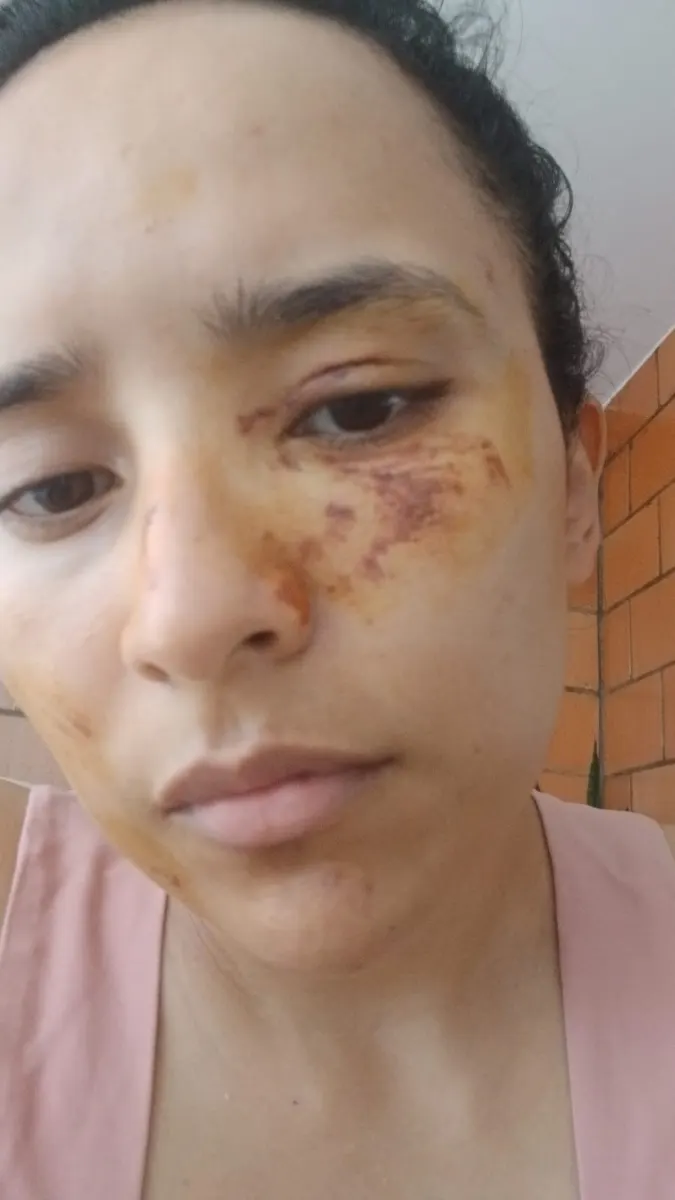 Foto 3 de los daños reportados por Elizabeth Posada Cometa